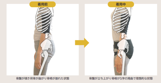 骨盤ベルト「フィットキープ2」で痩せる?産後1年使用した口コミまとめ